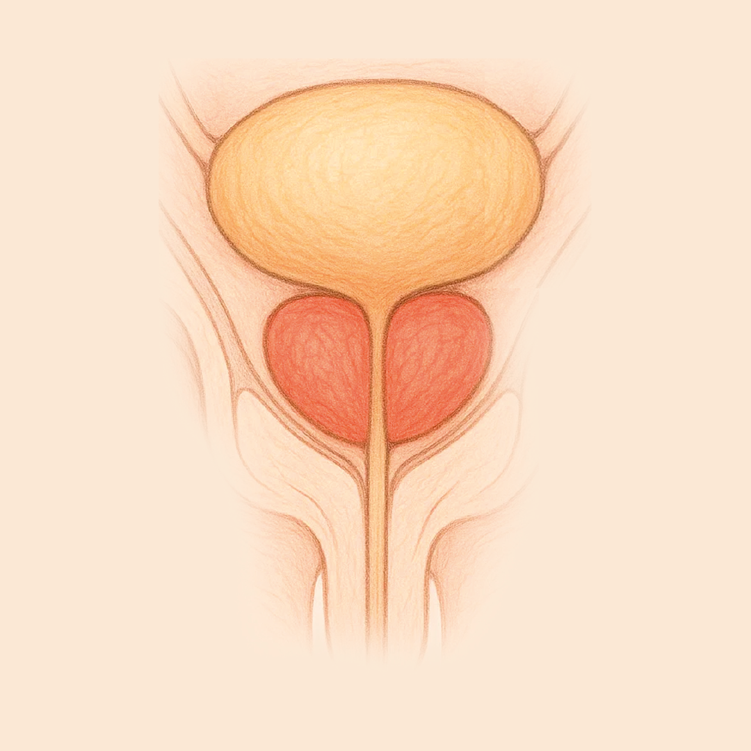 Hiperplasia de Próstata