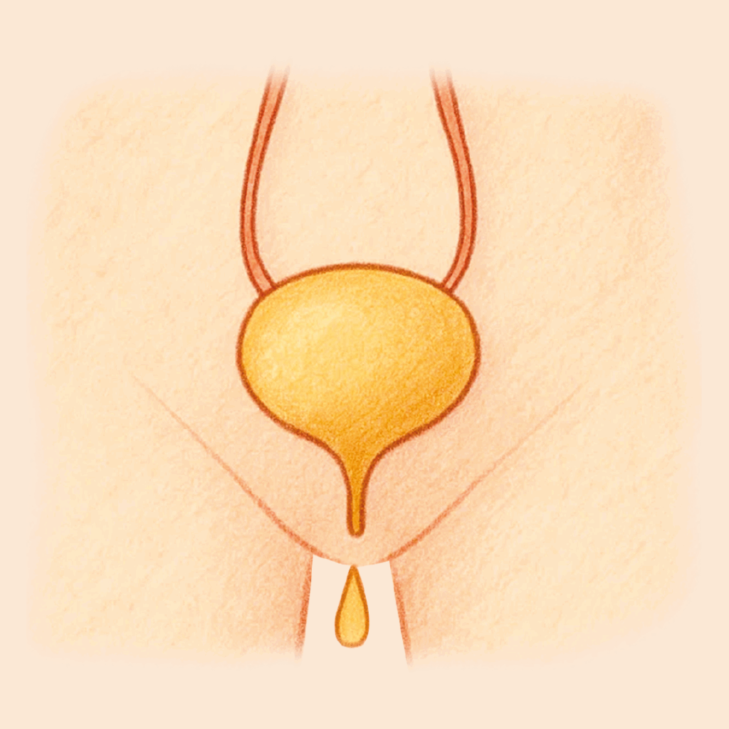 INCONTINENCIA URINARIA