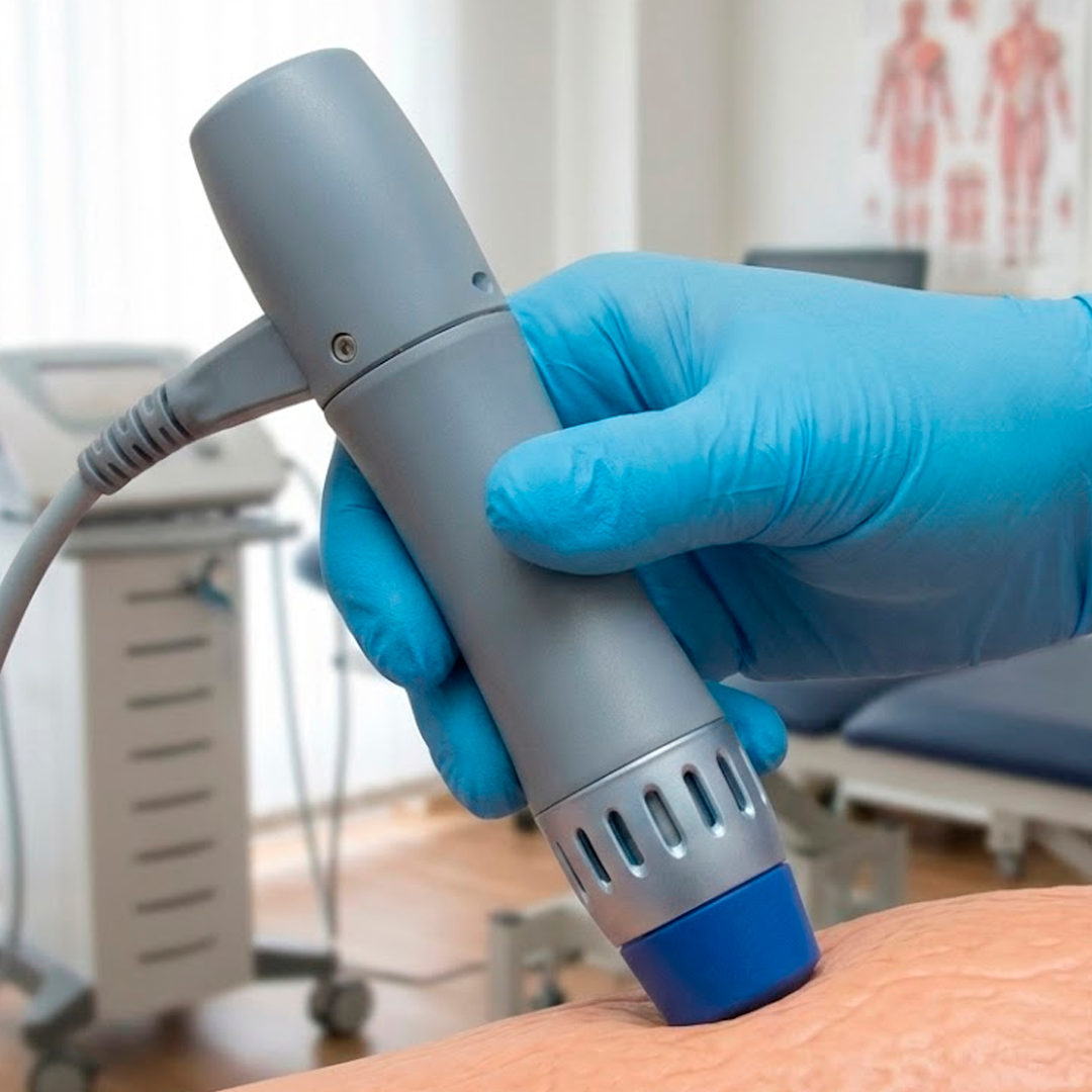 ONDAS DE CHOQUE LIMA